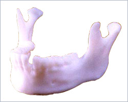 Jaw Reconstruction Study